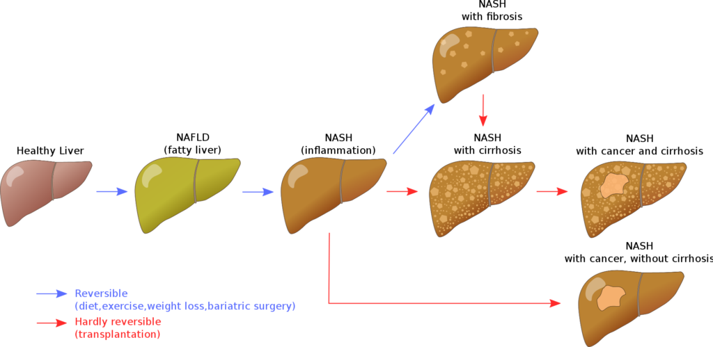 Cancer free Keto Diet