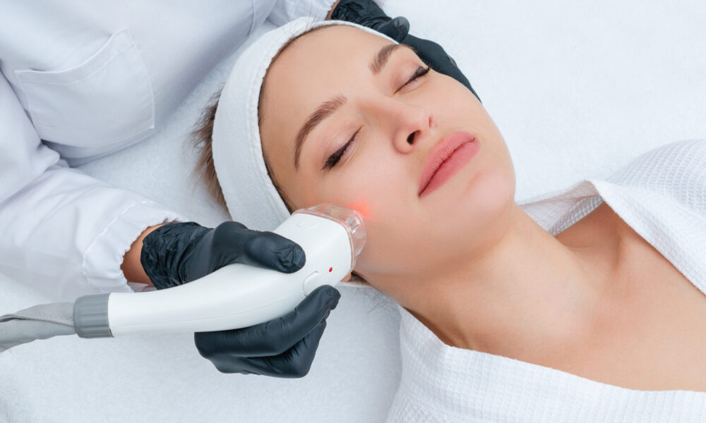 Laser resurfacing